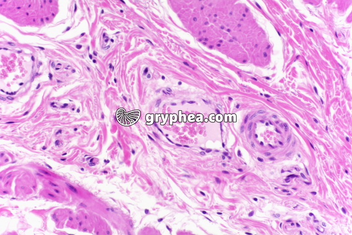 Vaisseaux sanguins en CT x100 - gryphea.com